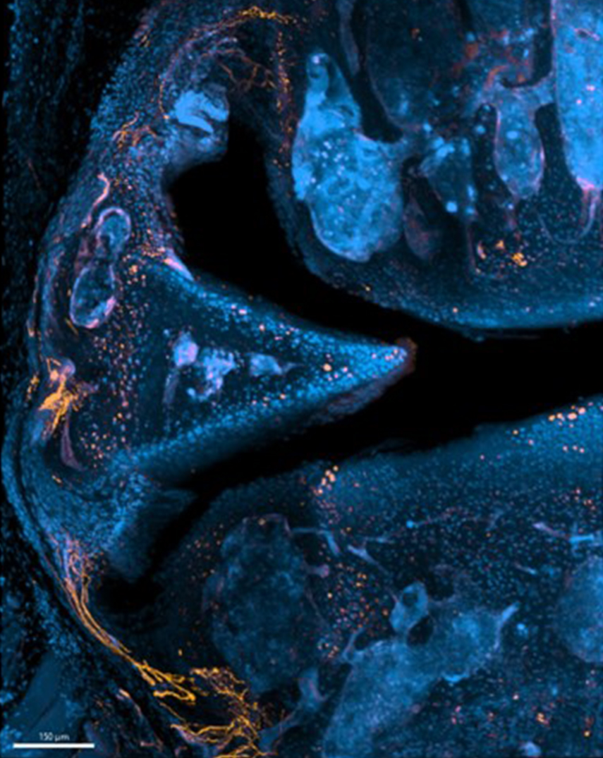The femur, meniscus and tibia of a mouse knee joint in a microscopy image. Credit: Haydee M. Torres, Ph.D.