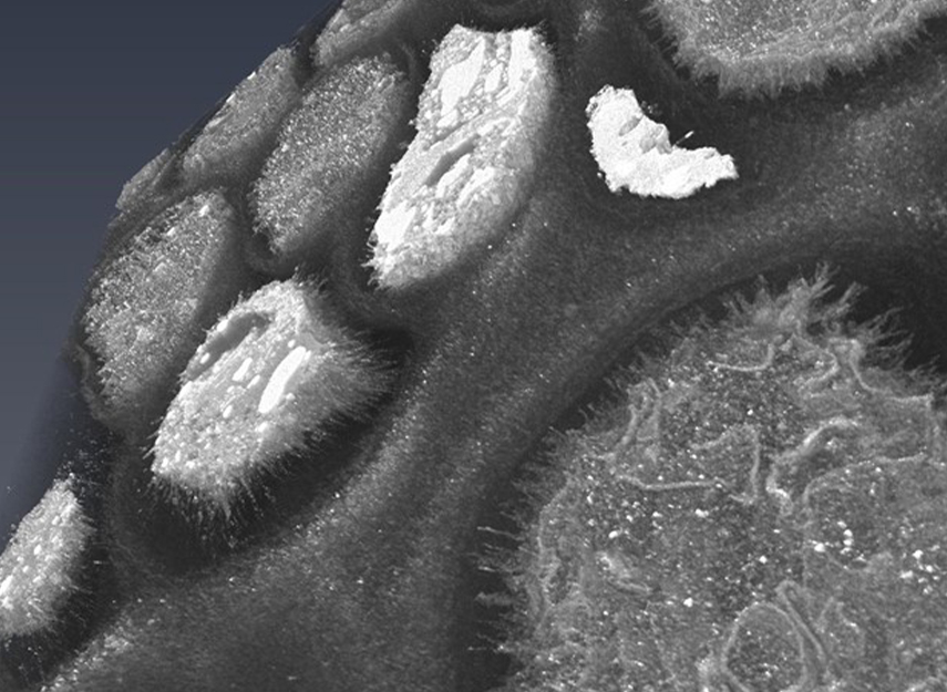 A 3D volume-rendered SEM image of chondrocytes surrounded by their pericellular matrix and extracellular matrix