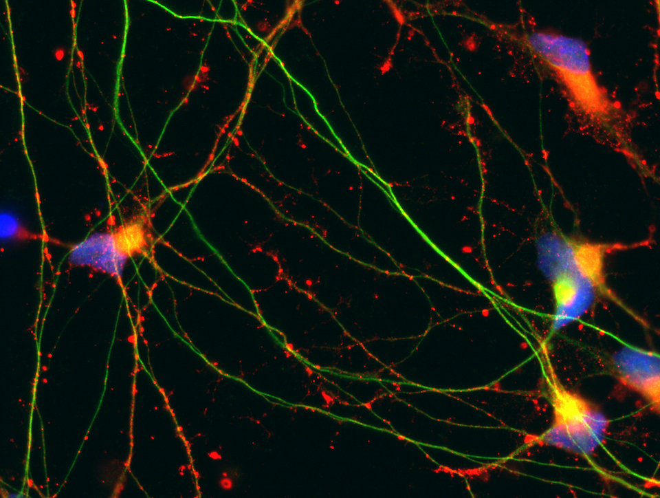 Human induced pluripotent stem cell (iPSC)-derived neural stem cells (NSCs)