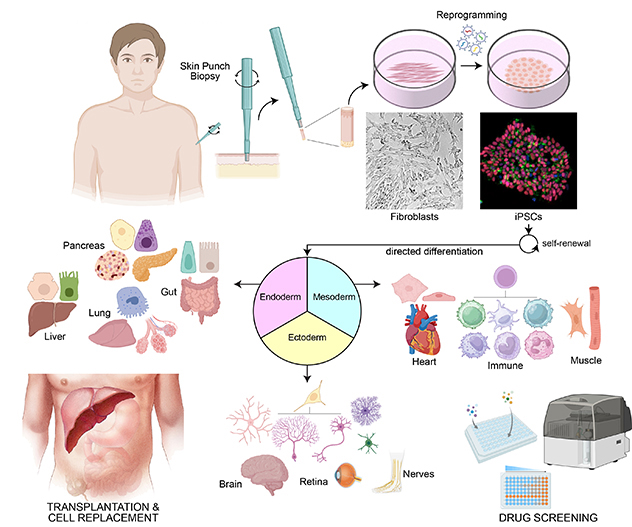 Diagram showing how fibroblasts are isolated from a skin punch biopsy and reprogrammed into induced pluripotent stem cells (iPSCs).