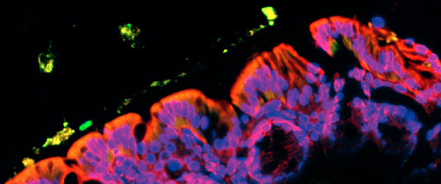 Microscopy image of C. diff biofilm