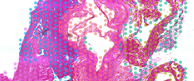 Multicolored dots represent different gene signatures layered over mouse cardiac tissue.