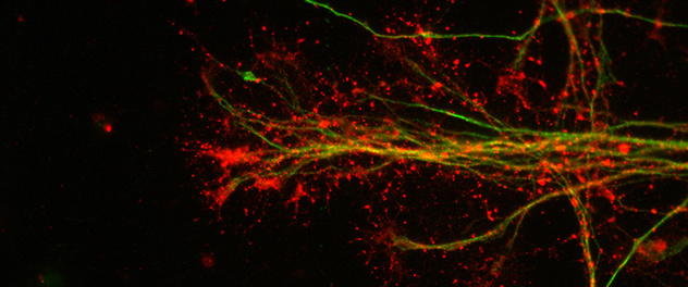 Human induced pluripotent stem cell-derived neural stem cells.