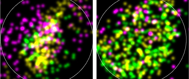 Super-resolution microscopy images of extracellular vesicles isolated from human brain tissues