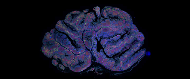 Whole-slide tonsil tissue