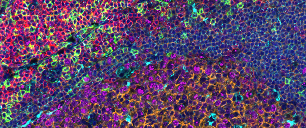 Whole-slide tonsil tissue