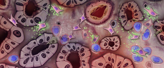 Mesenchymal stem cells are shown releasing various factors that affect surrounding cells in the damaged kidney tissues.