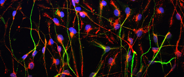 Neurons stained by immunofluorescence using different markers