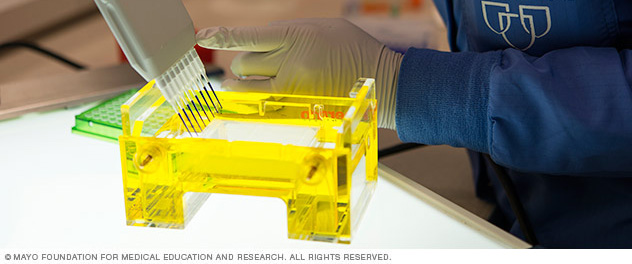 A researcher performs gel electrophoresis on several samples using a multichannel pipette.