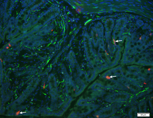 Microscopy image from Dr. Kashyap's Gut Microbiome Lab of enterochromaffin cells in the colonic mucosa