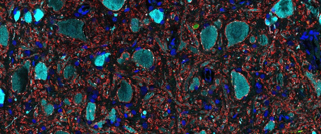 Spinal cord microscopy imaging