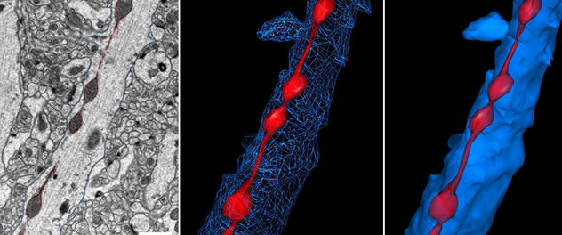 3 panel image showing standard TEM of mouse brain alongside 3D volume electron microscopy renderings.
