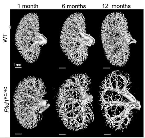 Series of 3D microcomputerized tomography images comparing the renal microvasculature of wild-type and Pkd1RC/RC mice at 1, 6 and 12 months of age.