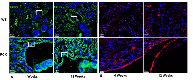 Immunofluorescence images of renal tissue from wild-type and PCK rats at 4 and 12 weeks of age show markers of oxidative stress and redox signaling. Green staining represents 8-hydroxyguanosine, red staining represents NOX4 and blue staining represents cell nuclei (DAPI). PCK kidneys show increased oxidative stress and NOX4 expression compared with wild-type kidneys, with staining intensity increasing as disease progresses from 4 to 12 weeks.