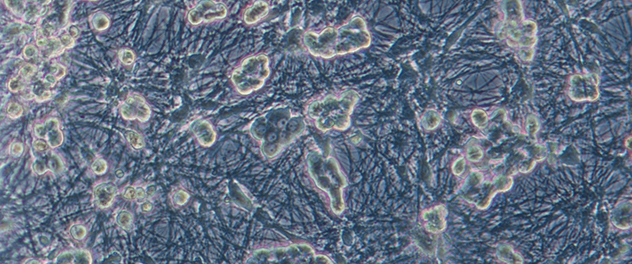 Sensory nerve cells growing in a culture dish.