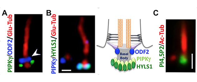 4-panel cilium diagram