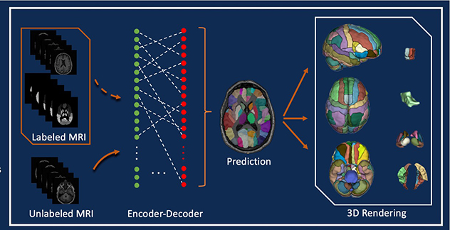 Deep brain structure segmentation