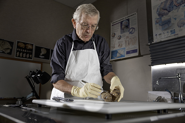 Dr. Dickson performs a brain autopsy.