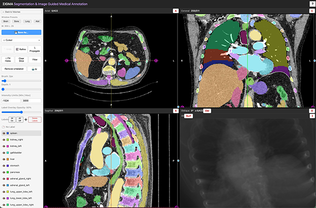 Main view of the open-source annotation software Sigma.