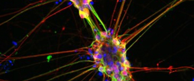 Cell under a microscope.
