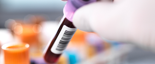 Blood sample.
